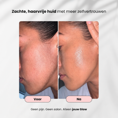 Silkora Pro – Pijnloze IPL Ontharing