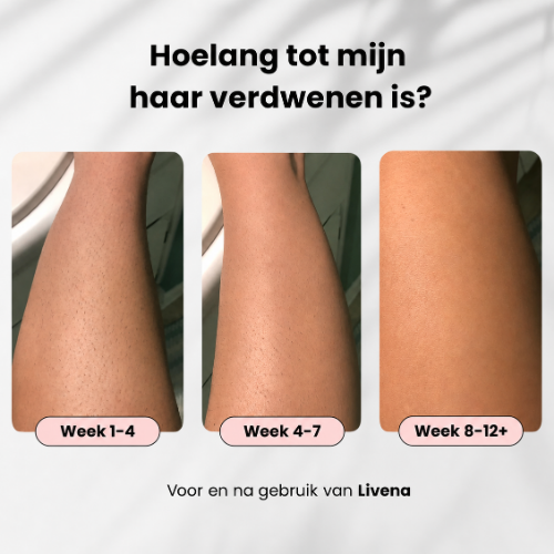 Silkora Pro – Pijnloze IPL Ontharing