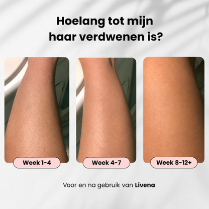 Silkora Pro – Pijnloze IPL Ontharing